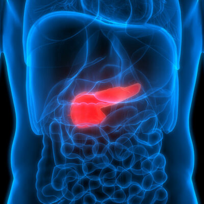 Pancreatic Cancer – 7 Risk Factors