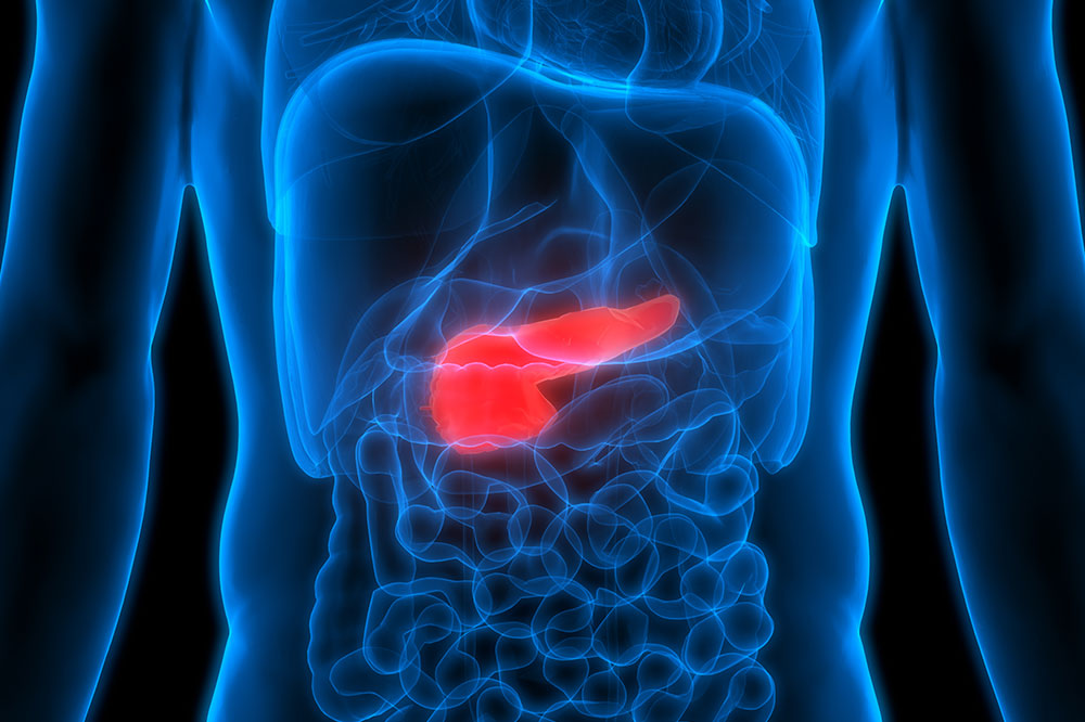 Pancreatic Cancer – 7 Risk Factors