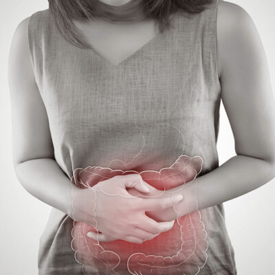 5 Common Causes of Colon Cancer