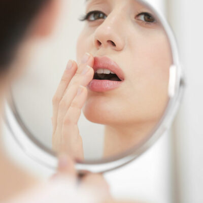 7 Common Cold Sore Triggers to Avoid