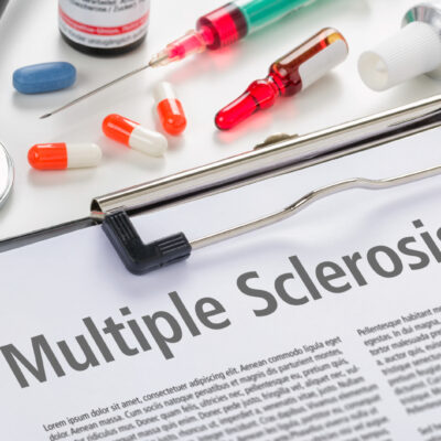 4 Early Warning Signs of MS and Treatments To Consider