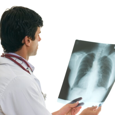 5 Warning Signs of Lung Cancer: